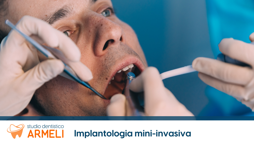 implantologia mini invasiva