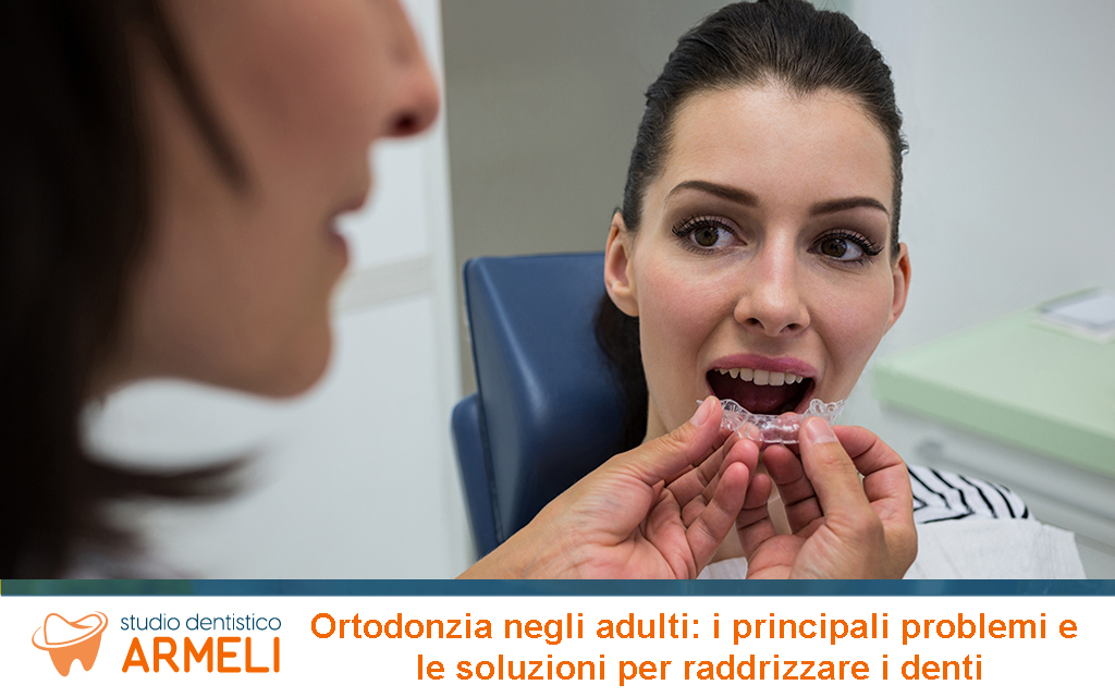 Ortodonzia Adulti Problemi e Soluzioni