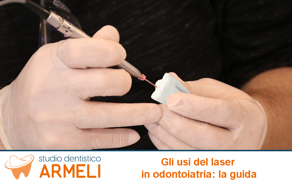 Gli Usi del Laser in Odontoiatria